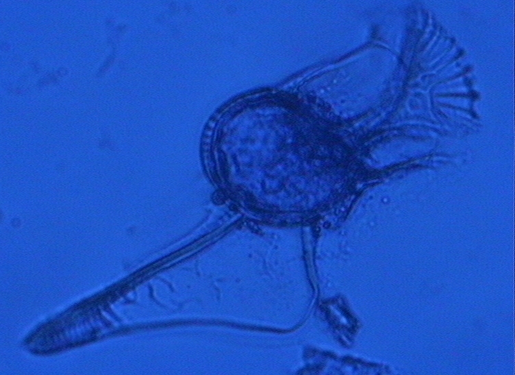 Dictyocha speculum